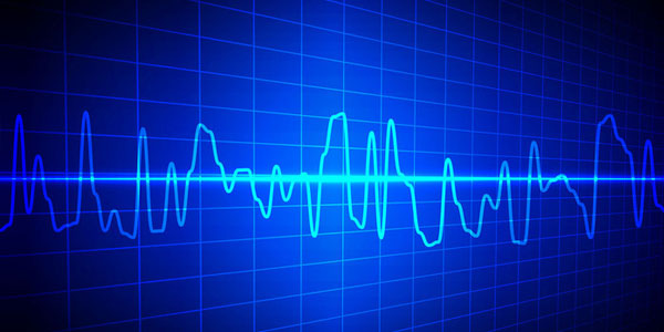 線圈灌封膠,環(huán)氧線圈灌封膠,醫(yī)療線圈灌封膠